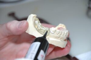 dental prosthesis
