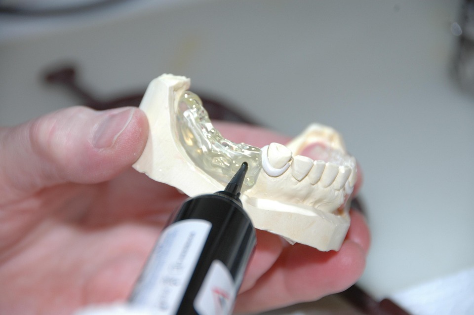 dental prosthesis